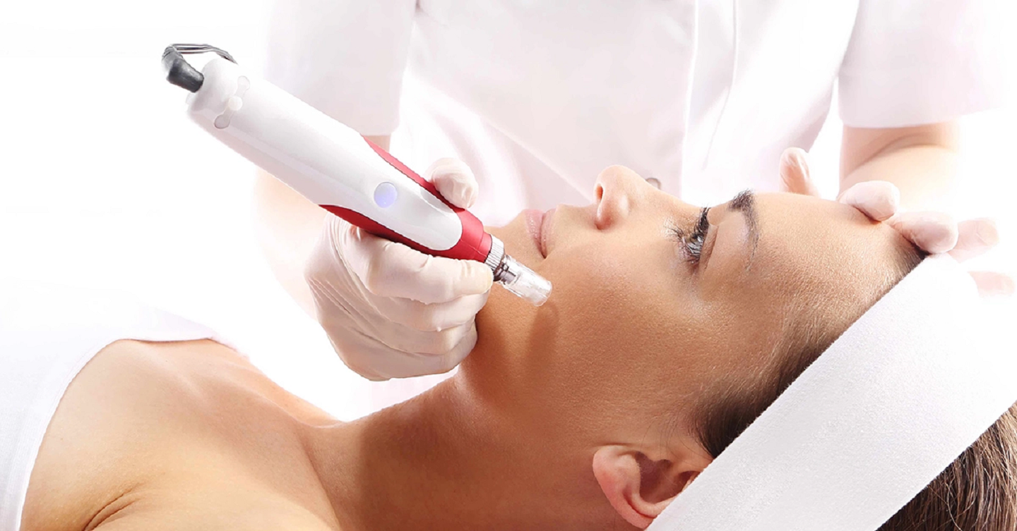 Acne Scar Microneedling in Dubai: Pros & Cons